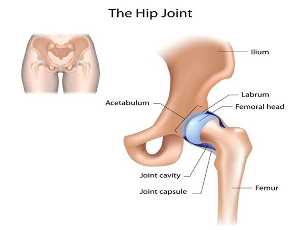 Hip pain