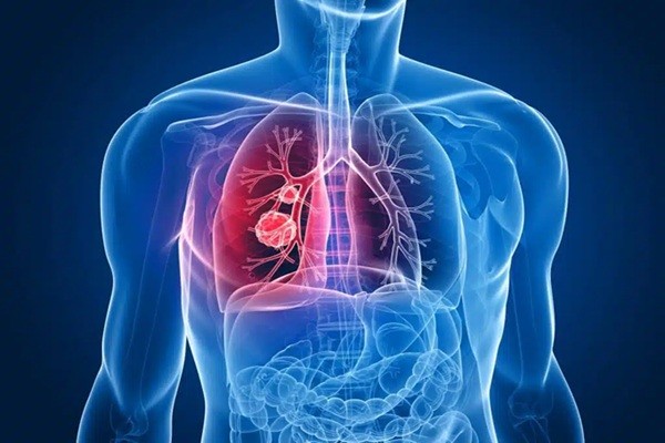 Pulmonary Function Tests