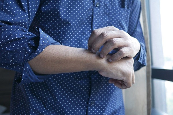 Itchy