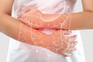 Rectal Bleeding